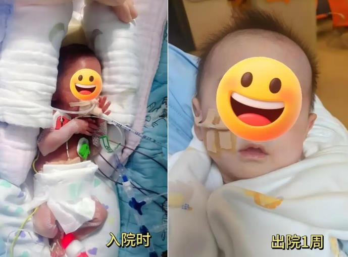 出生时体重仅475克，24周早产宝宝如今迎来“新生”